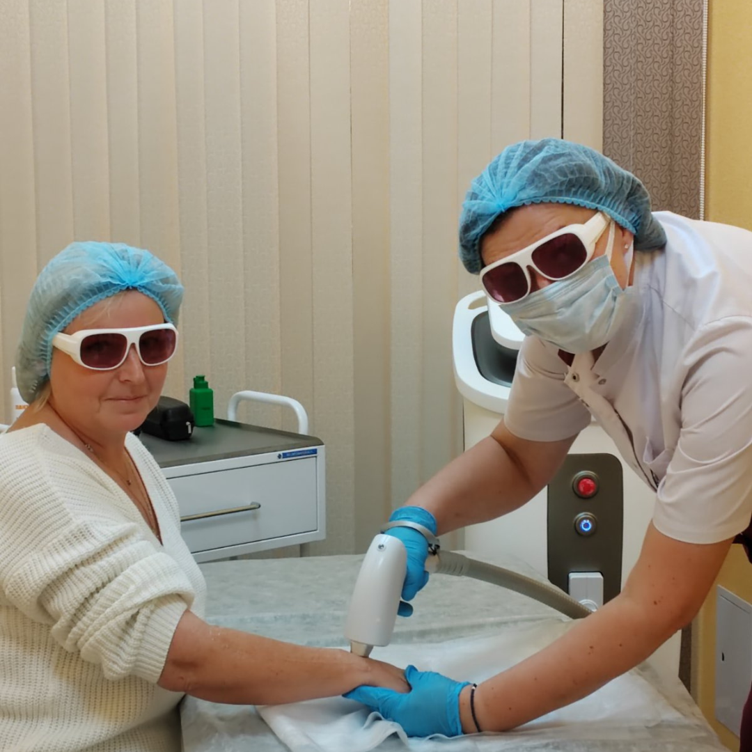 Лазерная эпилляция